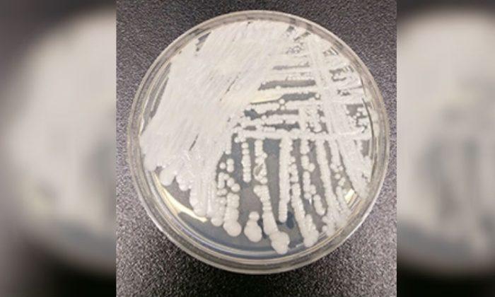 Oregon Hospital System Reports Outbreak of Rare Fungal Superbug