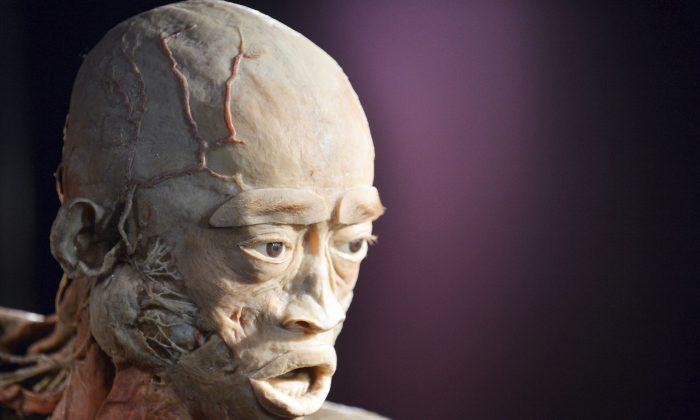 Critic of Human Cadaver Exhibition Aims to Pioneer Tests on Plastinated Tissue
