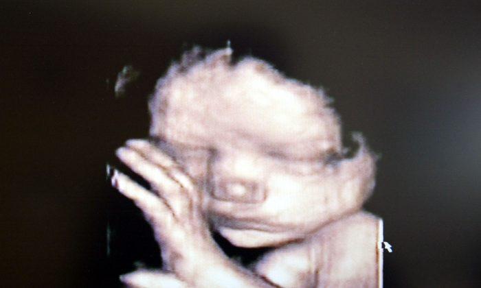 Florida Lawmakers Introduce Bill That Would Ban Abortions After Heartbeat Is Detected