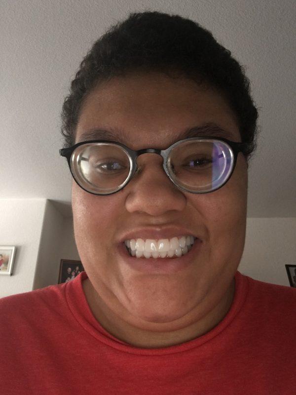 Yeadon's smile following her 2017 surgery from ProSmile. (Courtesy of Lori Bruegman)