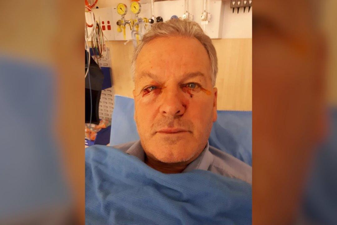 Canberra Man Checks on Seemingly Dead Kangaroo, Gets Hit With Surprise Attack