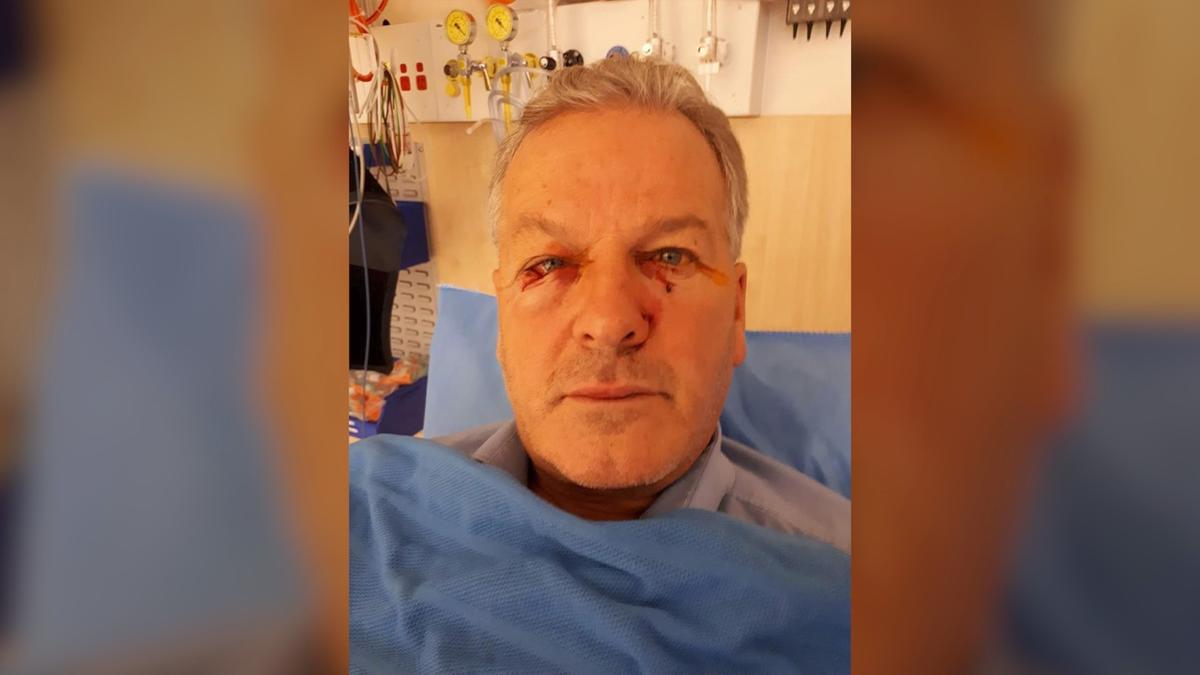 Canberra Man Checks on Seemingly Dead Kangaroo, Gets Hit With Surprise Attack