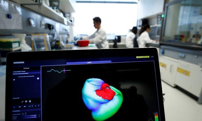 Tech Breakthrough Offers Early Warning System for Heart Attacks