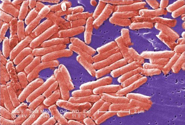 Gram-negative rod-shaped Salmonella bacteria. Public Health Image Library (PHIL)/WikiDoc)