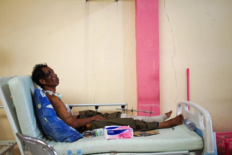 A victim of the earthquake and tsunami is pictured inside a hospital in Palu, Central Sulawesi, Indonesia, Oct. 4, 2018. (Reuters/Athit Perawongmetha)