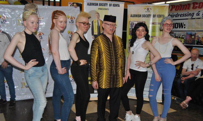 Beauty Beyond the Skin: Contestants in Africa Gear up for Albino Pageant