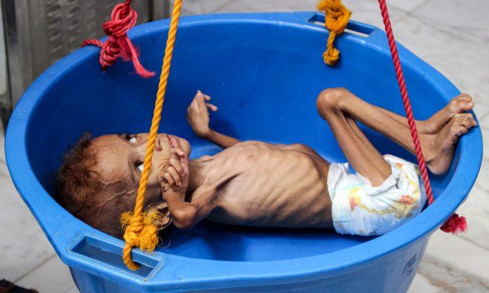 Yemen’s Nightmare: War Brings Famine