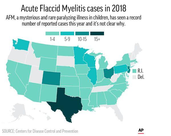Graphic shows confirmed cases of Acute Flaccid Myelitis cases in 2018. (AP/Photo File)