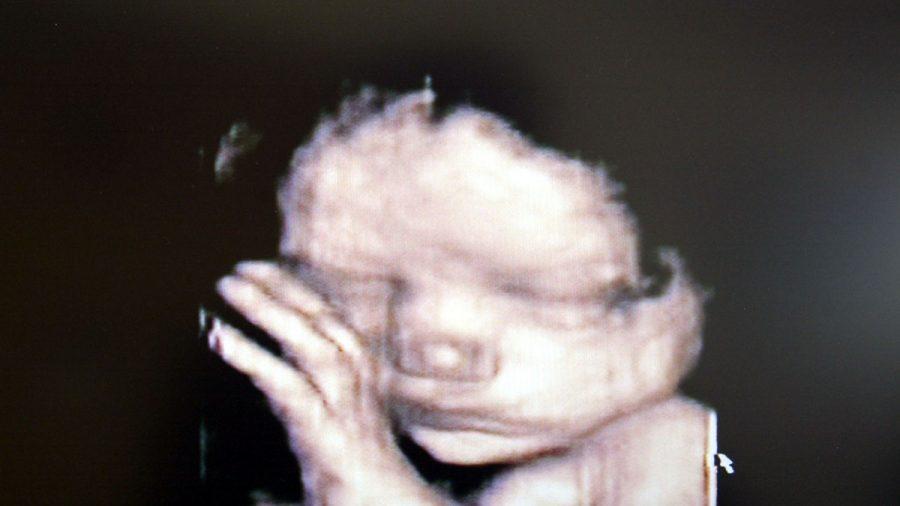 A 3D ultrasound showing a baby inside the womb. (Fotopress/Getty Images)