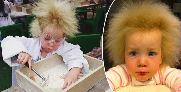 This young girl with ‘uncombable hair syndrome’ has hair like EINSTEIN, and she’s loving it!