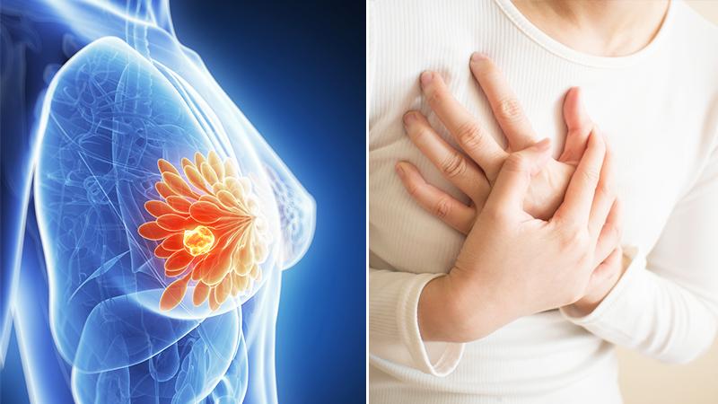 Breast Cancer Drug for Reducing Recurrence Risk Approved for Australia