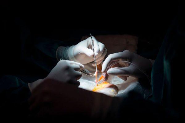 Doctors prepare for a kidney transplant in a file photo. (Pierre-Philippe Marcou/AFP/Getty Images)