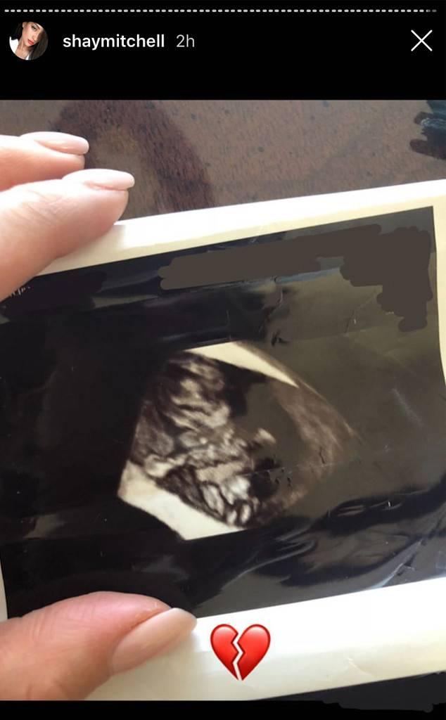 She included a photo of an ultrasound with a broken-heart emoji. (Shay Mitchell / Instagram)