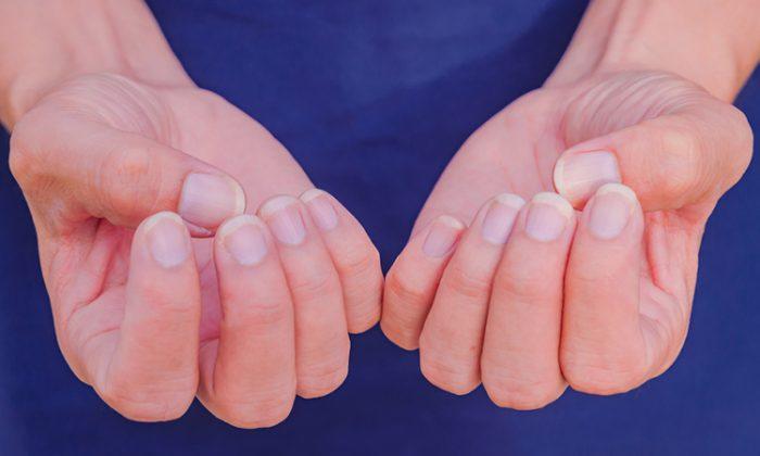 What Your Fingernails Can Tell You About Your Health, According to Western Medicine