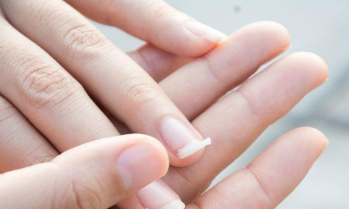 Woman’s Warning Goes Viral After Finding out Curved Fingernails Are a Sign of Lung Cancer