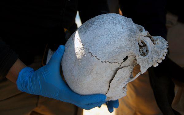 A forensic expert holds a human skull found during a search operation in the Juarez Valley, Chihuahua State, Mexico, on Aug. 18, 2018. (Herika Martinez/AFP/Getty Images)