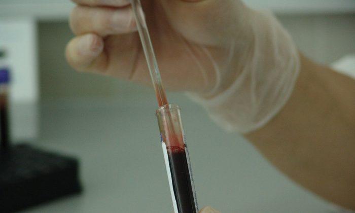 75-Year-Old Woman Died After Receiving Wrong Blood Type for Transfusion, Report Finds