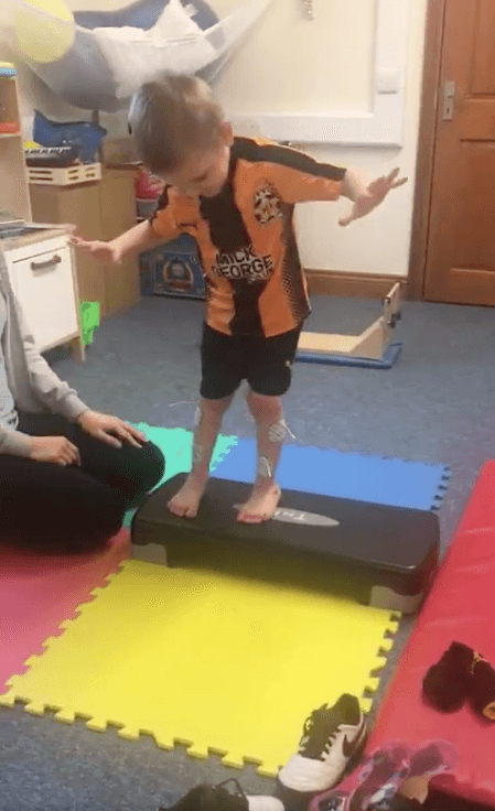 Four year old Ronnie is undergoing physiotherapy after an operation and recently walked his first steps without splints. (Steve Leys/Twitter)