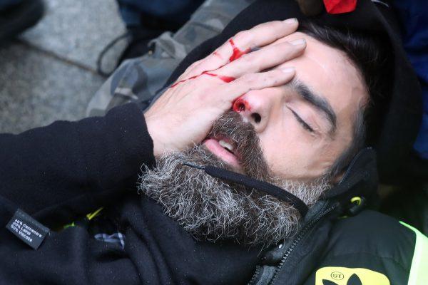 Jerome Rodrigues, one of the leaders of the "yellow vest" movement, lies on the street after getting wounded in the eye in Paris on Jan. 26, 2019. (Zakaria Abdelkafi/AFP/Getty Images)