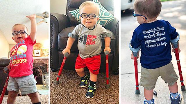 Mom Shares Video of Tot With Spina Bifida Learning to Walk