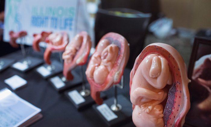 Late-Term Abortion: A Complex Moral Debate in America