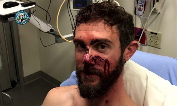 Travis Kauffman is pictured after a mountain lion attack on Feb. 4, 2019. (CWP)