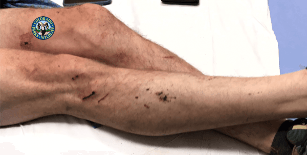 Scratches on Travis Kauffman's legs sustained in a mountain lion attack on Feb. 4, 2019. (CWP)