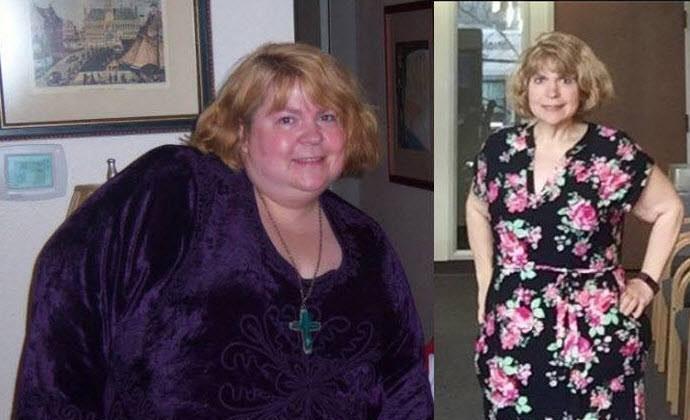 Supersized Mom Lost 300 Pounds After Beating Food Addiction That Almost Killed Her