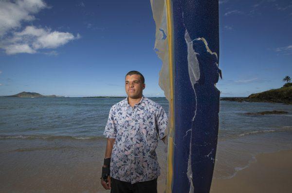 Juliun Perkins who was bitten by a shark on Sept. 8, 2018, while surfing outside of Pounders in Laie, sits on his surfboard that he was on during the attack, on Kailua beach in Oahu, Hawaii, on Feb. 22, 2019. (Cindy Ellen Russell/Honolulu Star-Advertiser via AP)