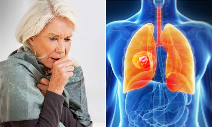 9 Warning Signs of Lung Cancer To Watch For—Are You Constantly Catching Your Breath?