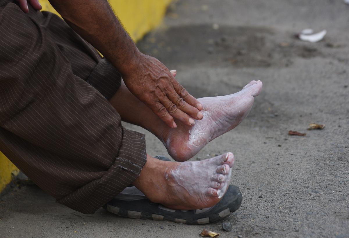 A Honduran migrant taking part in a caravan heading to the US, applies cream on his ailing feet, after arriving at the border crossing point with Mexico, in Ciudad Tecun Uman, Guatemala, on Oct. 19, 2018. (ORLANDO SIERRA/AFP/Getty Images)