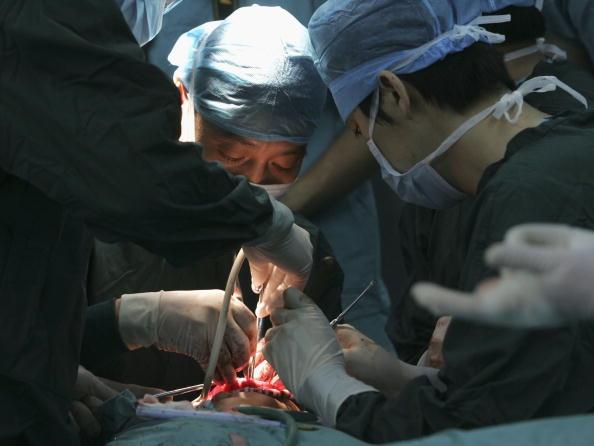Doctors operating on a patient. (China Photos/Getty Images)
