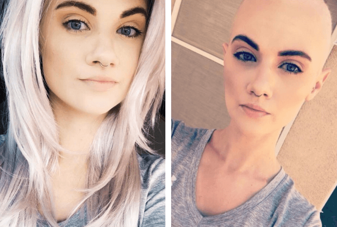 Meagan lost her hair due to chemotherapy. (Pic courtesy GoFundMe campaign by Tamara D Ferrigno)