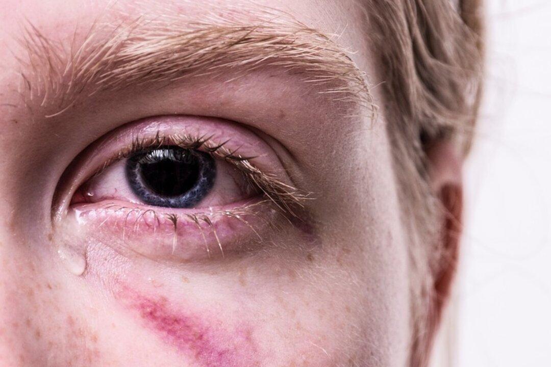 Miami University Student Hazed, Hit by ‘Paddle With Spikes’