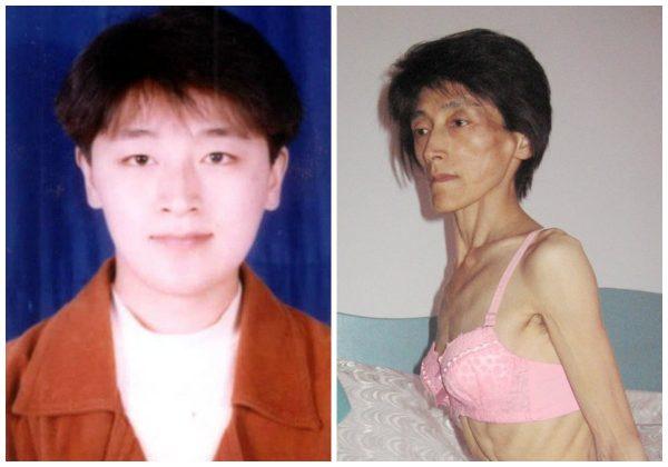 Song Yanqun before and after she was sent to prison, in violation of China's own laws. (Minghui.org)