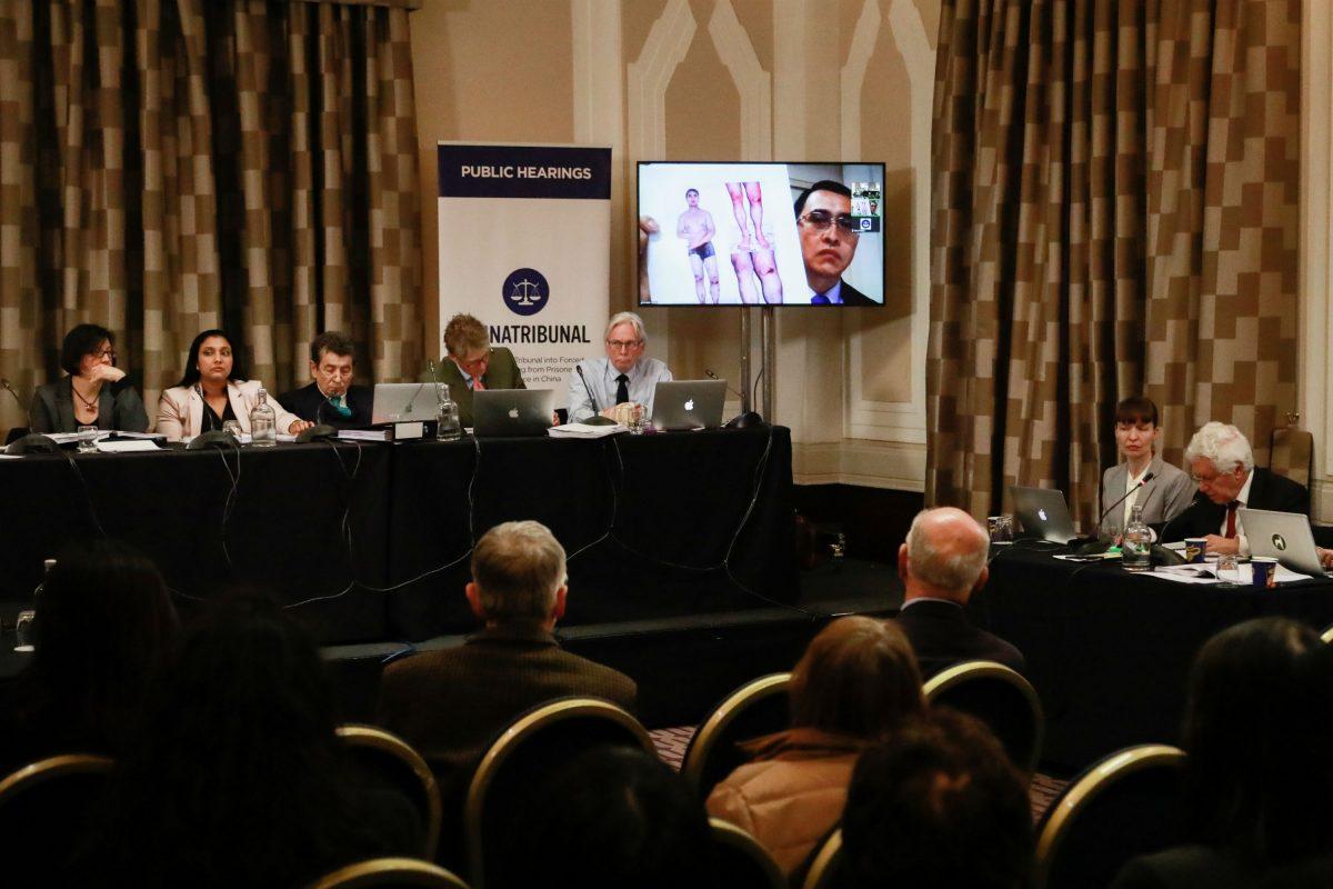 Witness Yu Ming shows panel members images of injuries he suffered from being tortured while at a labor camp in China. His evidence was given via video link on April 6, 2019. (endtransplantabuse.org)