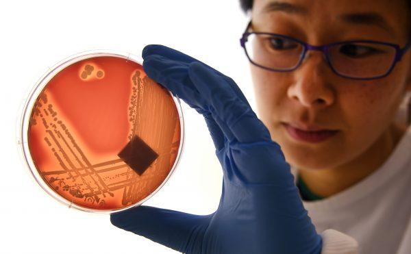 A PhD student at Melbourne's Doherty Institute inspects the superbug Staphylococcus epidermidis on an agar plate in Melbourne on September 4, 2018. (WILLIAM WEST/AFP via Getty Images)