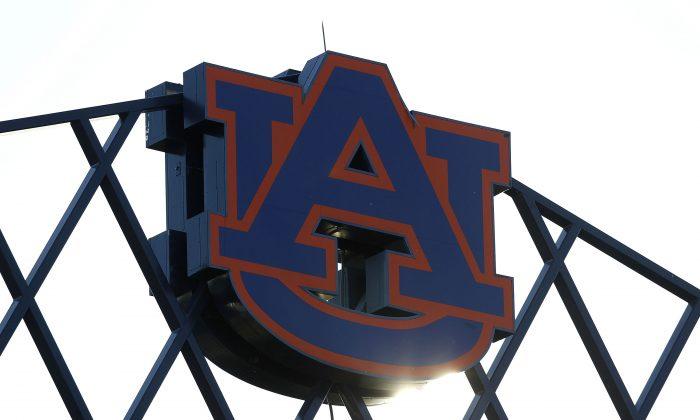 Auburn Gymnast Has Successful Surgery After Severely Injuring Both Legs, Says Coach