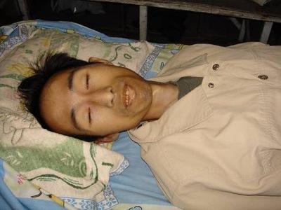  Lei Ming after being released from prison. (Minghui.org)