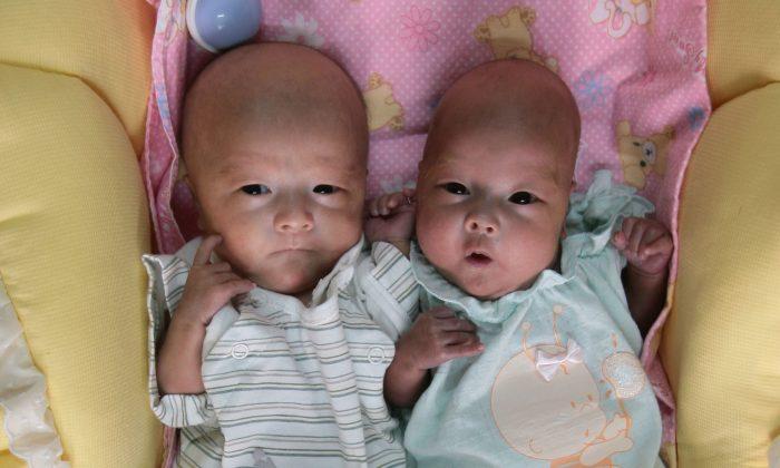 Identical Twin Sisters Spotted ‘Fighting’ in Mother’s Womb During Ultrasound Scan