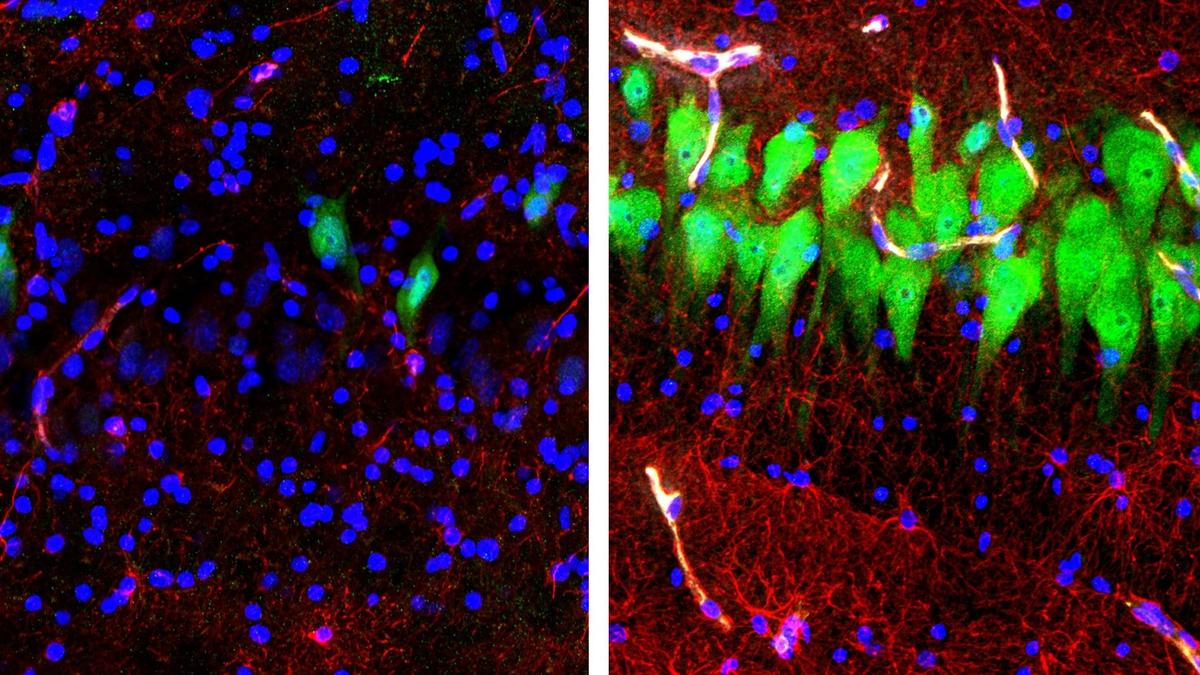 Scientists Restore Some Activity in Brains of Slaughtered Pigs