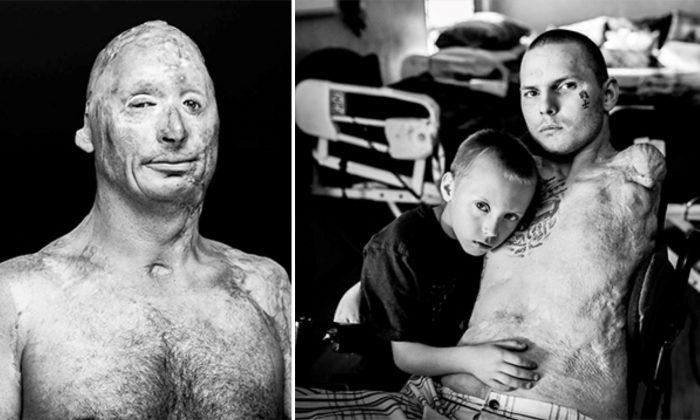 10 Graphic Photos of Heroic Veterans After War in Iraq and Afghanistan: No Words Needed