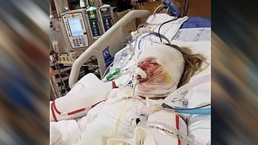 Candle Engulfed a Sofa in Flames and Burned a 6-Year-Old in Neighboring Apartment