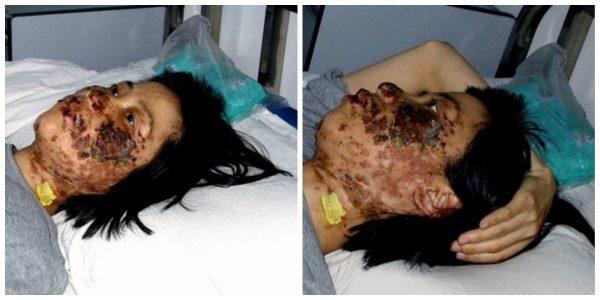 Photos of Gao Rongrong taken on May 7, 2004, 10 days after her face was shocked repeatedly with electric batons for more than seven hours by guards at the Longshan Forced Labor Camp. (Minghui.org)