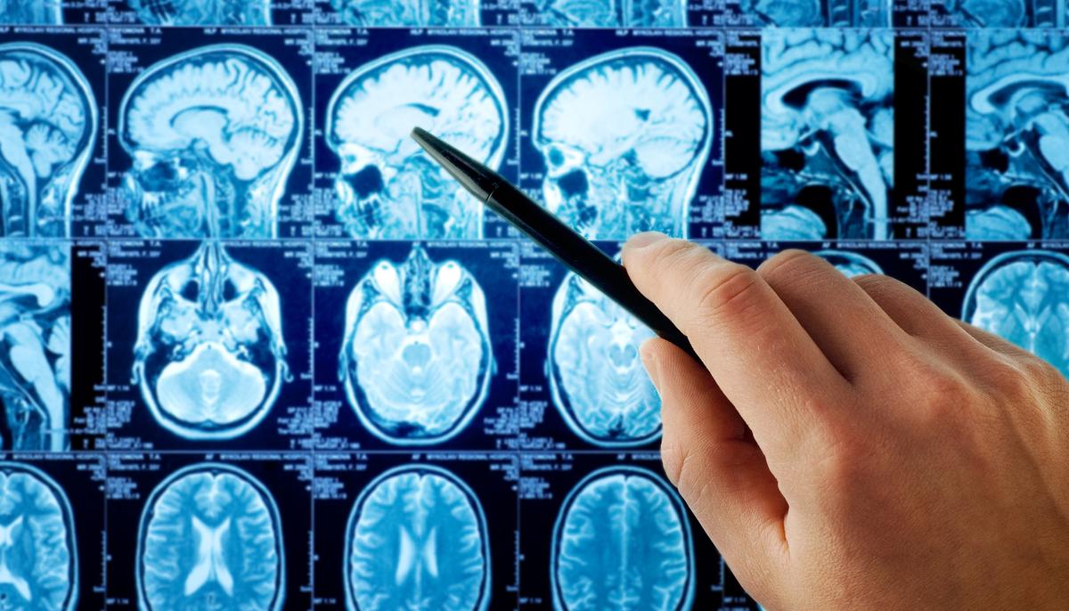 New Brain Cancer Drug Passes Phase One of Trial