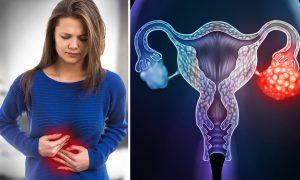 5 Signs That Could Mean Ovarian Cancer–Early Stages Are Hard to Detect, Here’s How