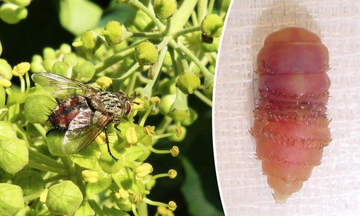Painful Lumps on Woman’s Scalp Turn Out to Be Parasitic Botfly Larvae