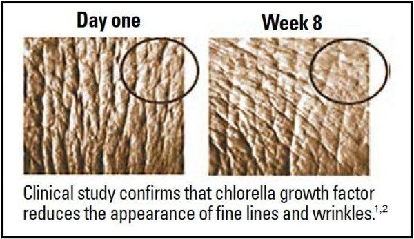 A clinical skin study on chlorella