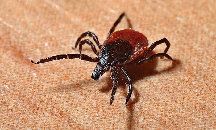 17-Year-Old Boy Dies of Heart Infection From Tick Bite
