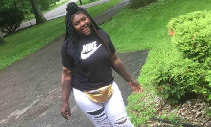 Girl Who Burned 49 Percent of Her Body During ‘Fire Challenge’ Issues Warning, Thanks God